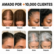El sérum para el crecimiento del cabello #1 de Corea.