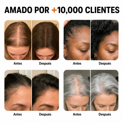 El sérum para el crecimiento del cabello #1 de Corea.