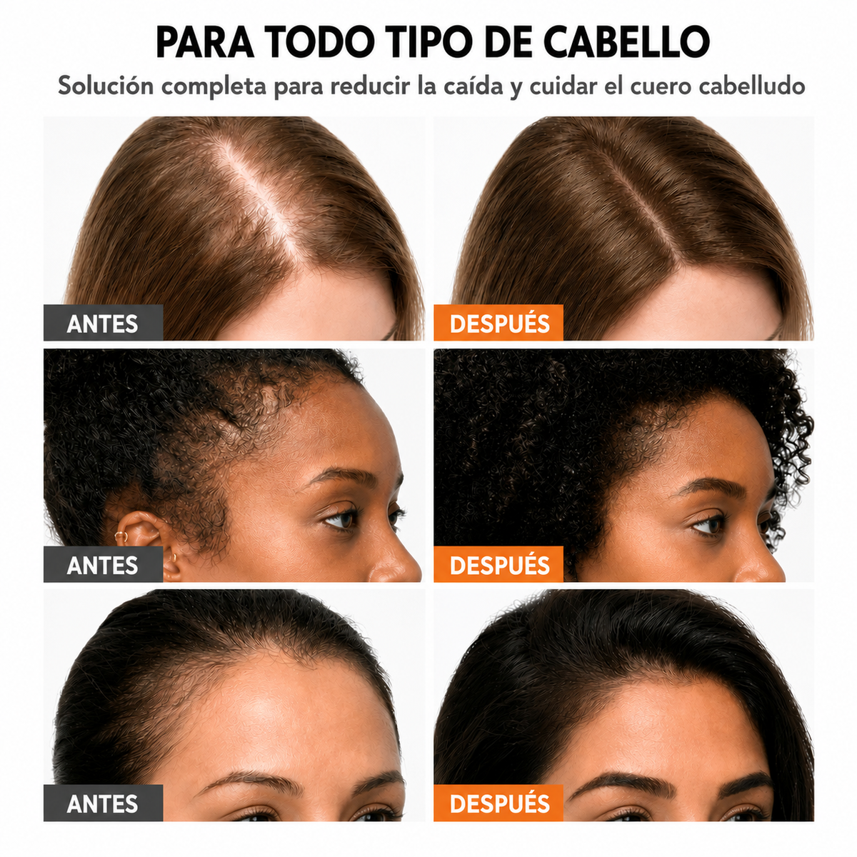 El sérum para el crecimiento del cabello #1 de Corea.