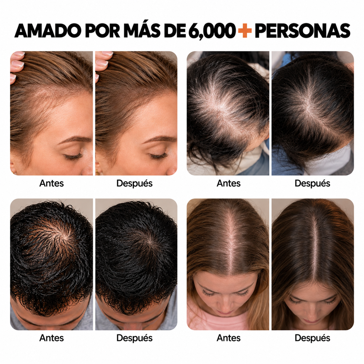 El champú para el crecimiento del cabello #1 de Corea.