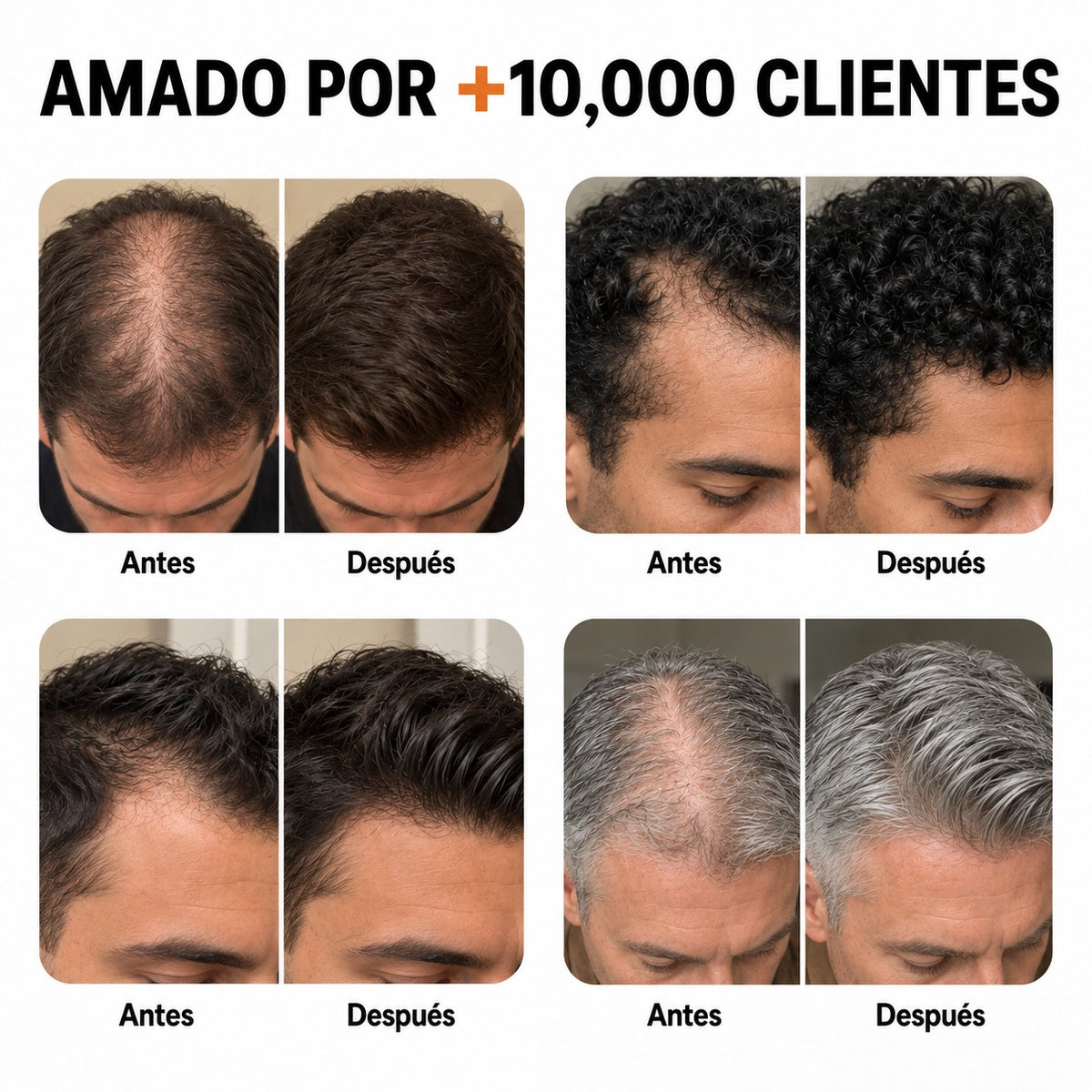 El sérum para el crecimiento del cabello #1 de Corea.