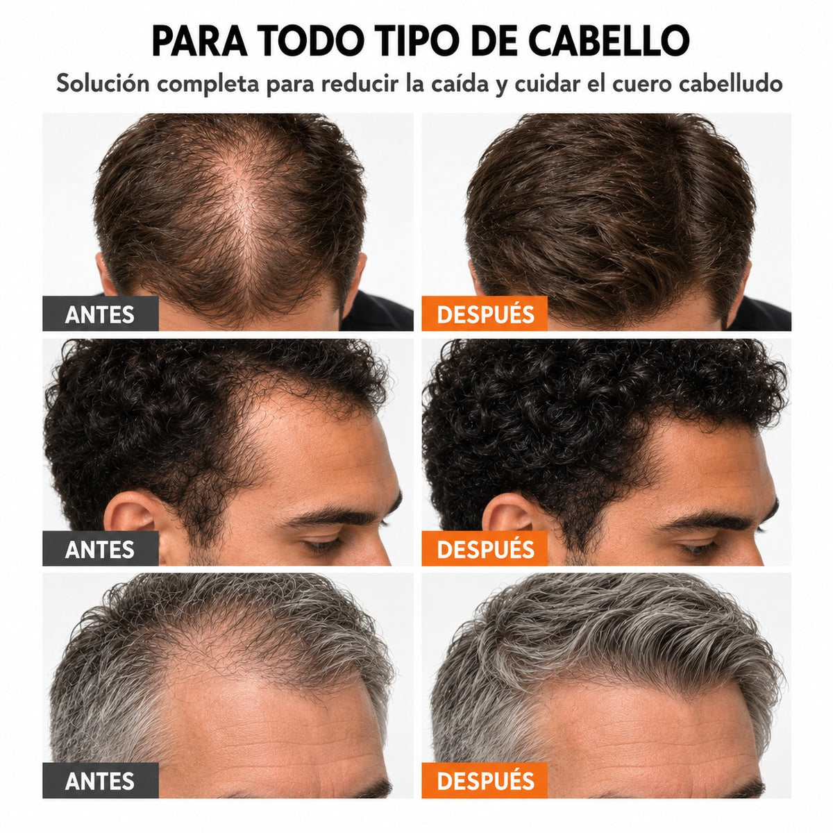 El sérum para el crecimiento del cabello #1 de Corea.